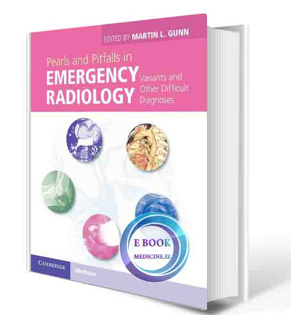 دانلود کتابPearls and Pitfalls in Emergency Radiology: Variants and Other Difficult Diagnoses 1st (ORIGINAL PDF)